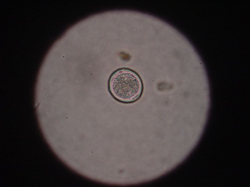 protozoa worm